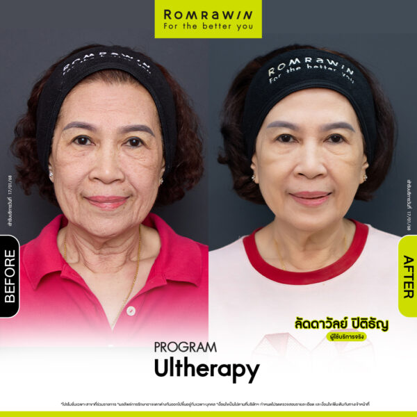 รีวิว อัลเทอร่า คุณลัดดาวัลย์