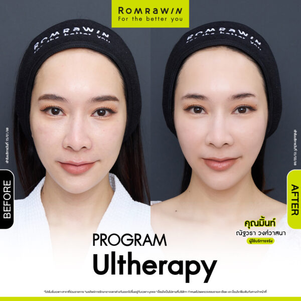 รีวิว อัลเทอร่า คุณมิ้นท์