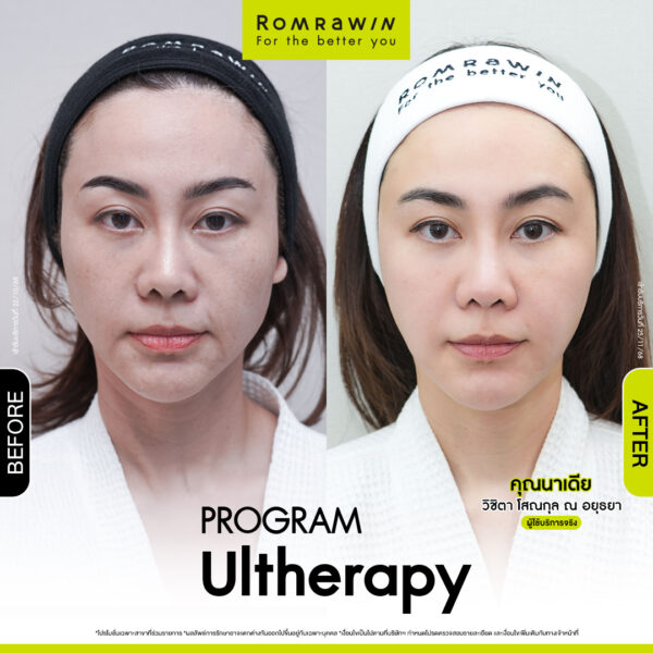 รีวิว อัลเทอร่า คุณนาเดีย