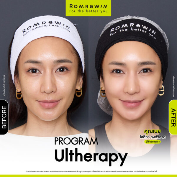 รีวิว อัลเทอร่า คุณเนย