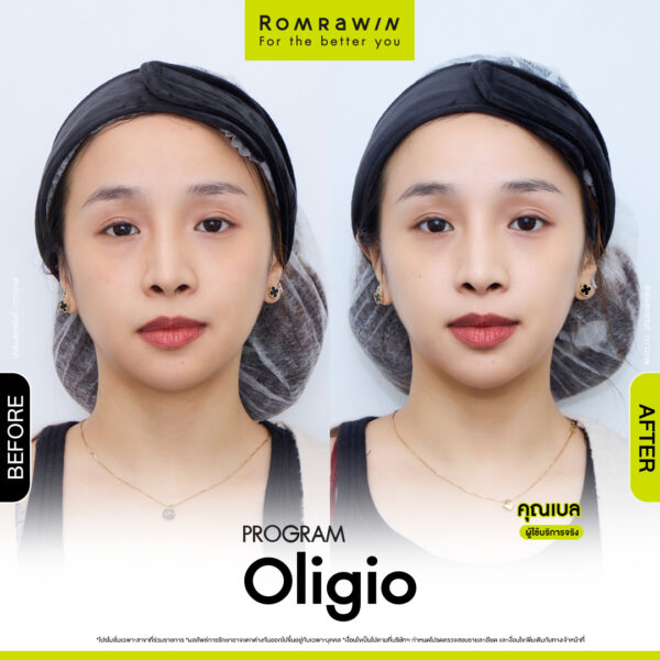 รีวิว Oligio คุณเบล
