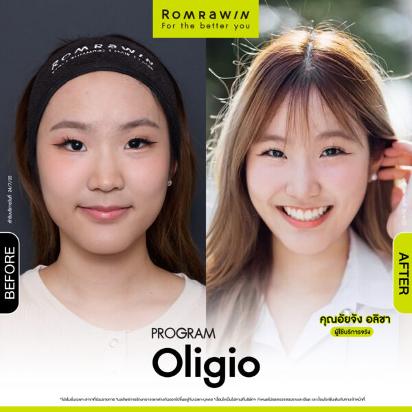 รีวิว Oligio คุณอัยจัง