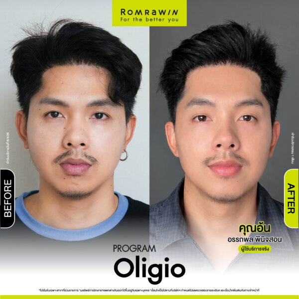 romrawin review oligio aon