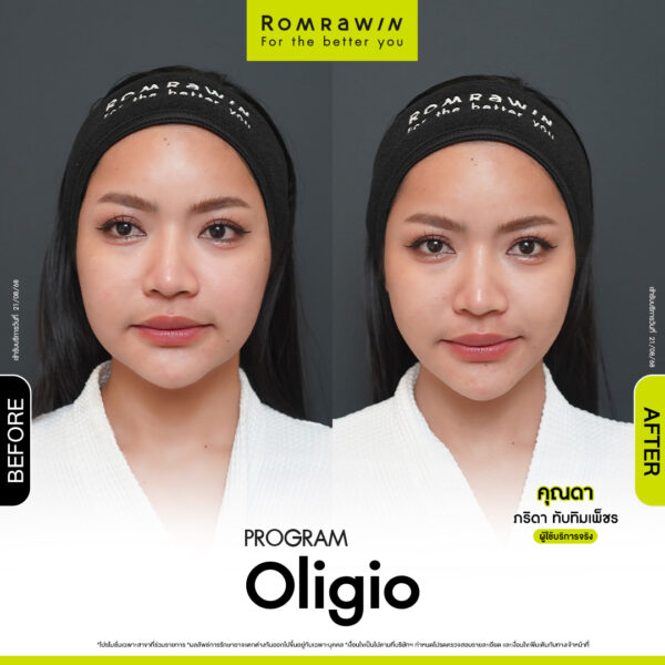 รีวิว Oligio คุณดา