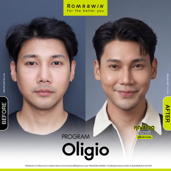 รีวิว Oligio คุณข้าวตู