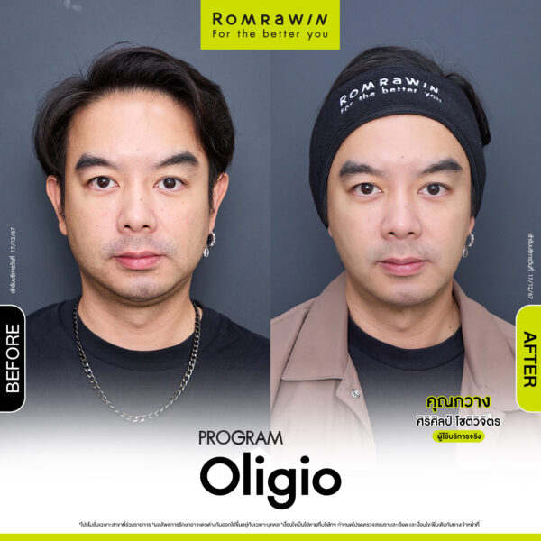 รีวิว Oligio คุณกวาง