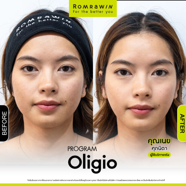 รีวิว Oligio คุณเนย