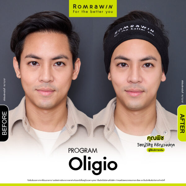 รีวิว Oligio คุณพิช