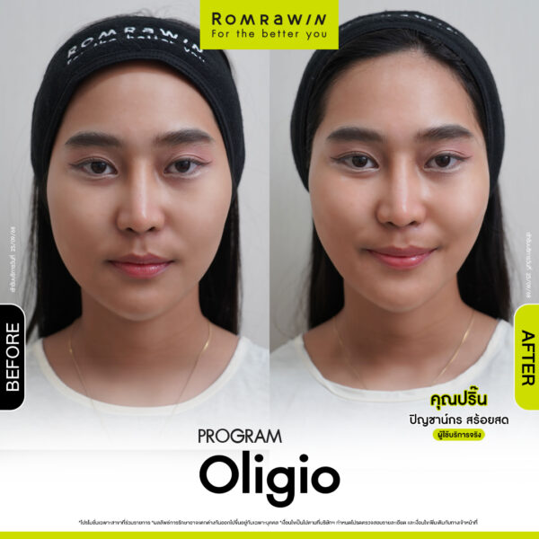 รีวิว Oligio คุณปริ๊น