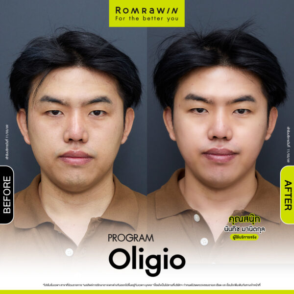 รีวิว Oligio คุณสนุ๊ก
