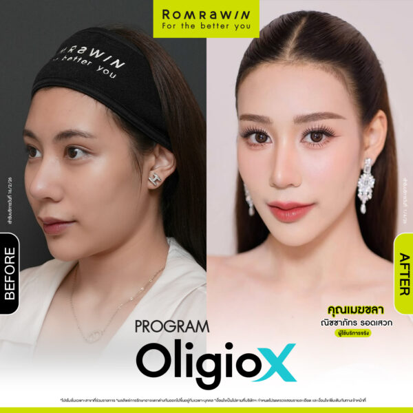 รีวิว Oligio X คุณเมขลา