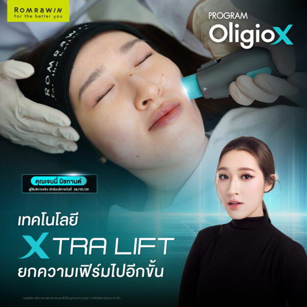 X Mode เทคโนโลยีใหม่ของ OligioX ดียังไง ทำไมใครๆถึงถูกใจ 4 รีวิว OligioX