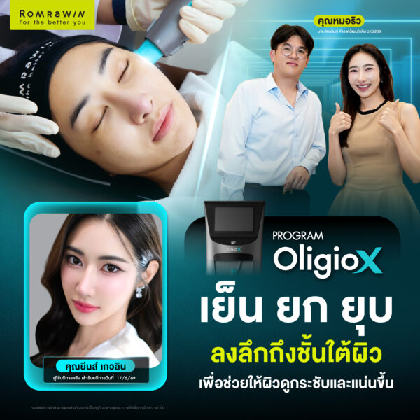 X Mode เทคโนโลยีใหม่ของ OligioX ดียังไง ทำไมใครๆถึงถูกใจ 2 รีวิว Oligio X