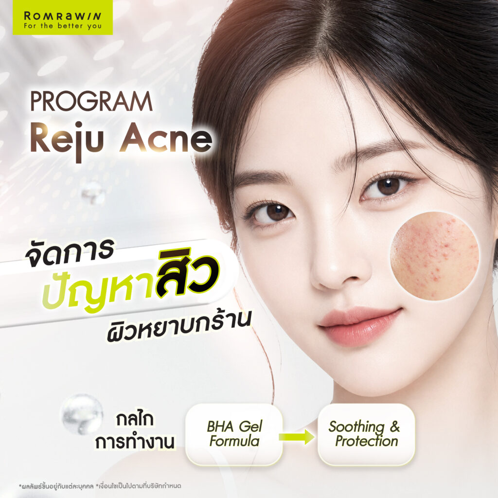Reju Peeling สยบสิว ฝ้า และริ้วรอย 4 สูตรที่ 2 Reju Acne จัดการทุกปัญหาสิวและผิวหยาบกร้าน ทั้งใบหน้าและผิวกาย