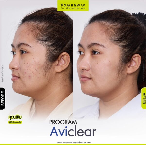 aviclear pim