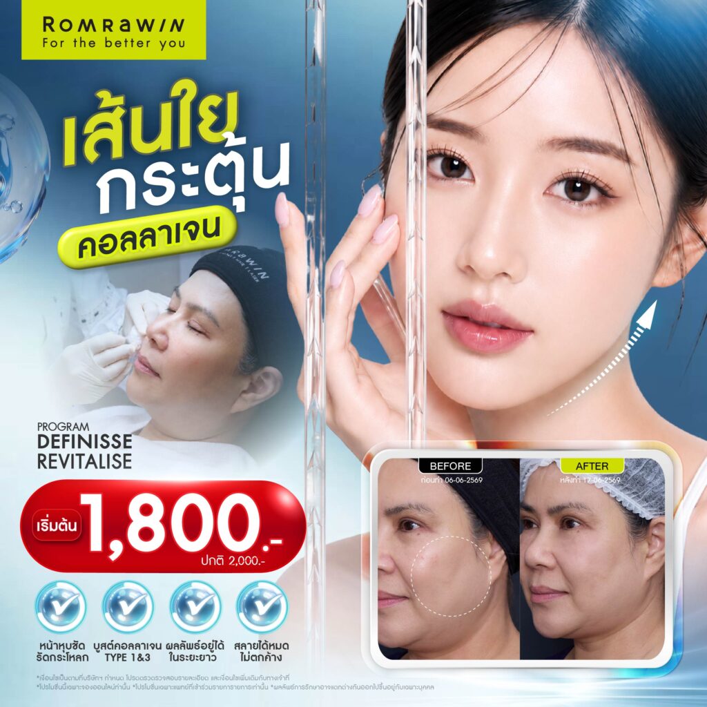 Definisse Revitalise ไหมงานผิว คืนความอ่อนวัยและแข็งแรงให้ผิวถึงระดับโครงสร้าง 7 Definisse Revitalise ราคา