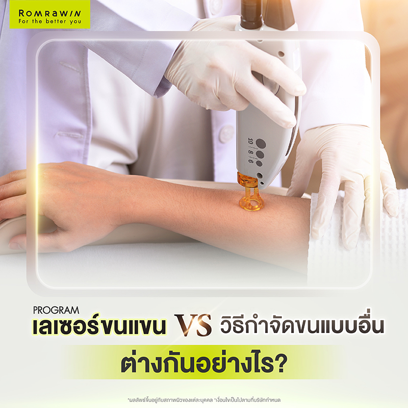 เลเซอร์ขนแขน ทางลัดสู่ผิวเรียบเนียนแบบไม่ต้องโกน 6 เลเซอร์ขนแขน VS วิธีกำจัดขนแบบอื่น ต่างกันอย่างไร?