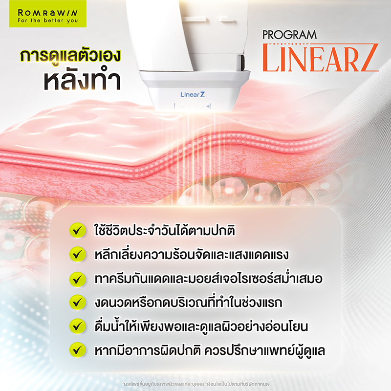 Linear Z ราคาเท่าไหร่? อัปเดตราคา พร้อมข้อมูลก่อนตัดสินใจทำ 6 การดูแลตัวเองหลังทำ Linear Z