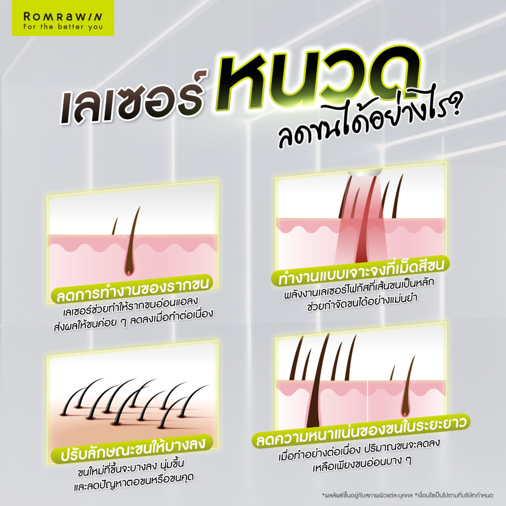 กำจัดหนวด เลเซอร์หนวดอย่างมั่นใจ ยับยั้งวงจรขนเกิดใหม่ 3 เลเซอร์หนวด กำจัดหนวด ลดขนได้อย่างไรในระยะยาว