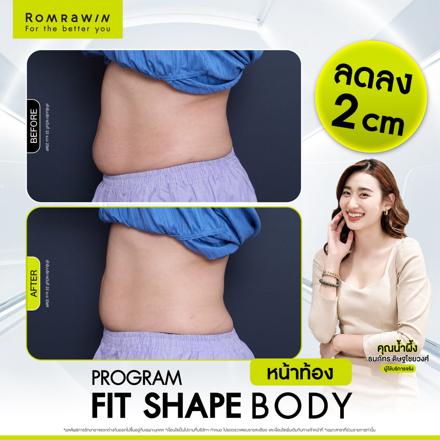 รีวิว Fit Shape Body หน้าท้อง คุณน้ำผึ้ง