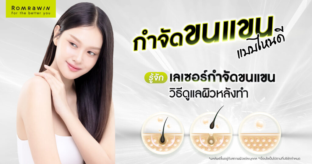 กำจัดขนแขนแบบไหนดี? รู้จักเลเซอร์กำจัดขนแขนและวิธีดูแลผิวหลังทำ 1 กำจัดขนแขน