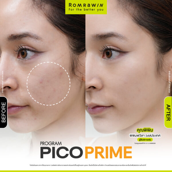 รีวิว Pico Prime คุณพิพิม