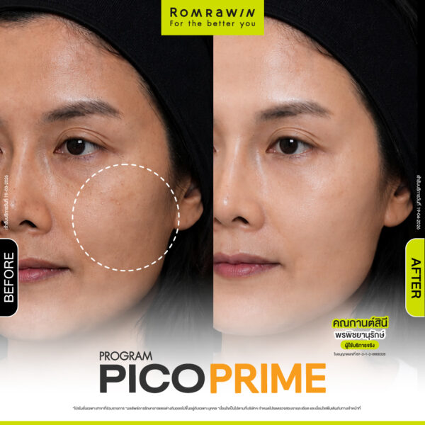 รีวิว Pico Prime คุณกานต์สินี