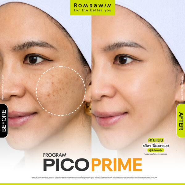 รีวิว Pico Prime คุณแนน