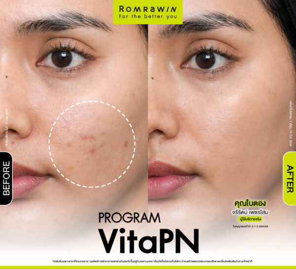รีวิว Vitaran คุณใบตอง