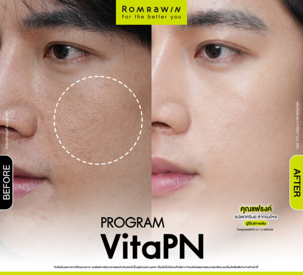 รีวิว Vitaran คุณแฟรงค์