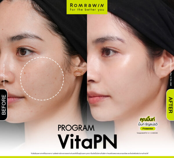 รีวิว Vitaran คุณมิ้นท์