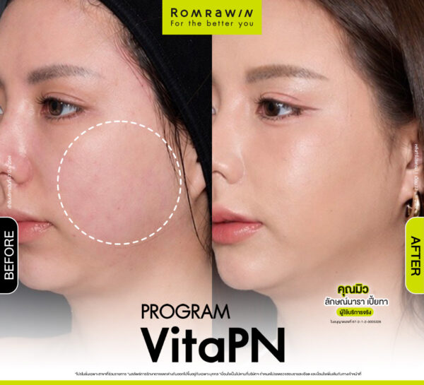 รีวิว Vitaran คุณมิว