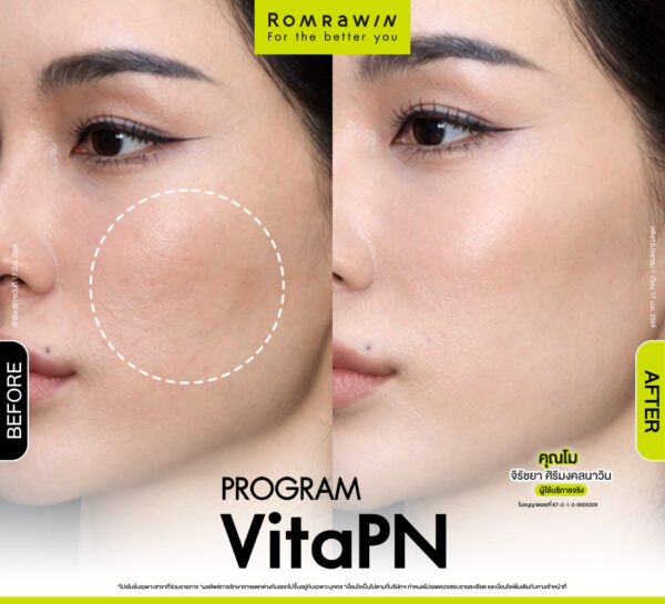 รีวิว Vitaran คุณโม