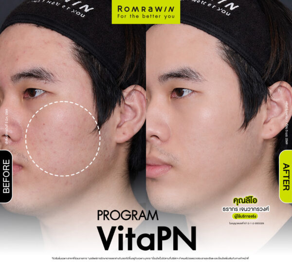 รีวิว Vitaran คุณลีโอ