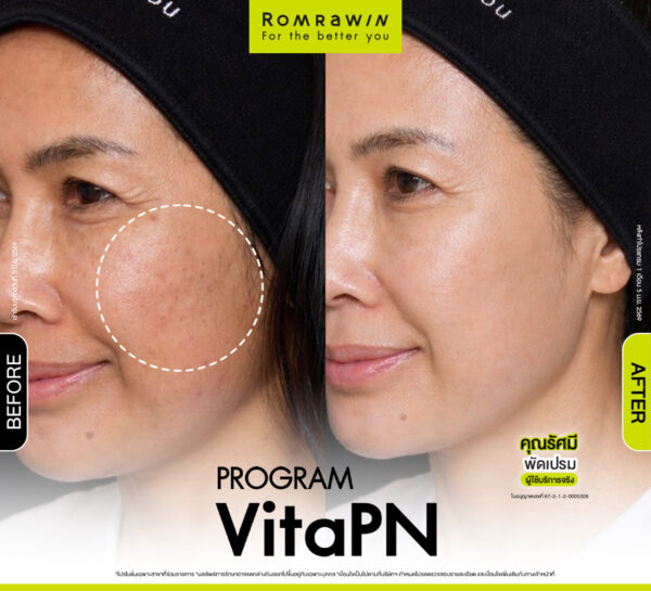 รีวิว Vitaran คุณรัศมี
