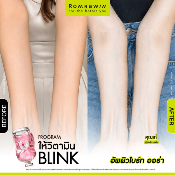 รีวิว ให้วิตามิน Blink คุณเก๋