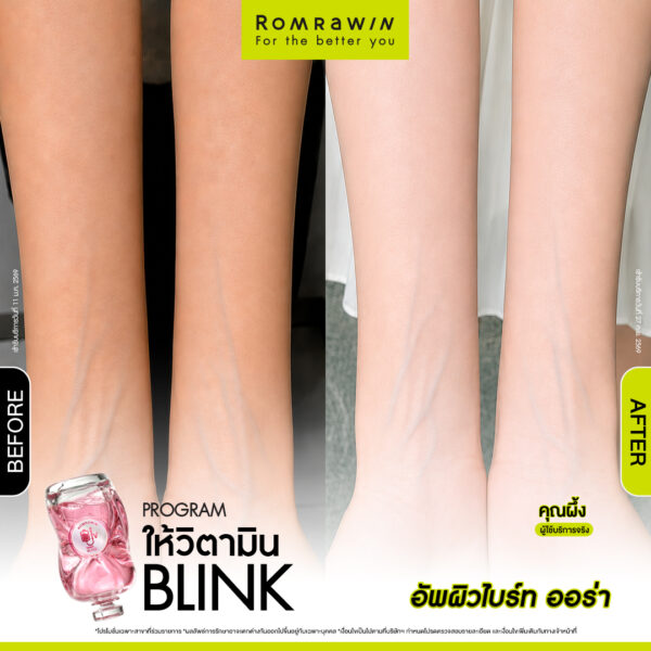 All Review 158 รีวิว ให้วิตามิน Blink คุณผึ้ง