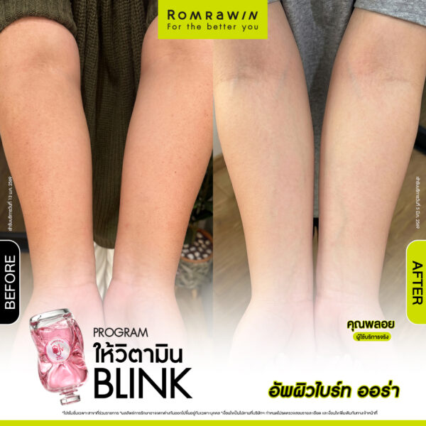 All Review 159 รีวิว ให้วิตามิน Blink คุณพลอย