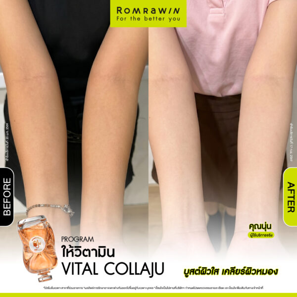 All Review 163 รีวิว ให้วิตามิน Vital Collaju คุณนุ่น