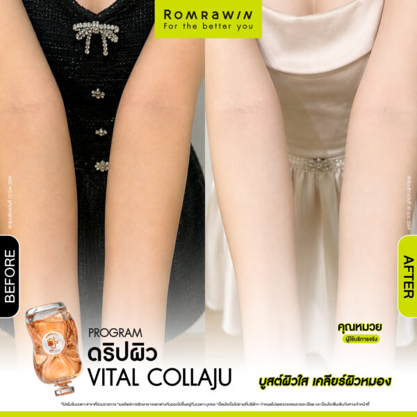 All Review 165 รีวิว ให้วิตามิน Vital Collaju คุณหมวย