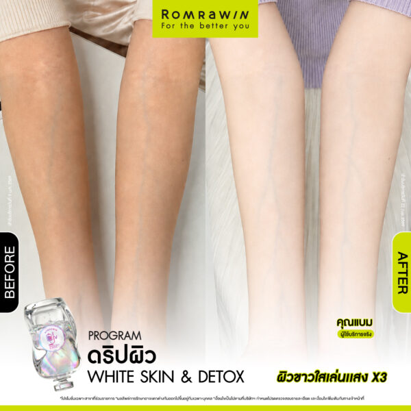All Review 167 รีวิว ให้วิตามิน White Skin & Detox คุณแบม
