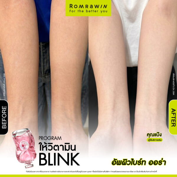 All Review 160 รีวิว ให้วิตามิน Blink คุณแป้ง