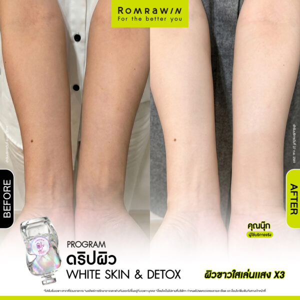 All Review 169 รีวิว ให้วิตามิน White Skin & Detox คุณนุ๊ก