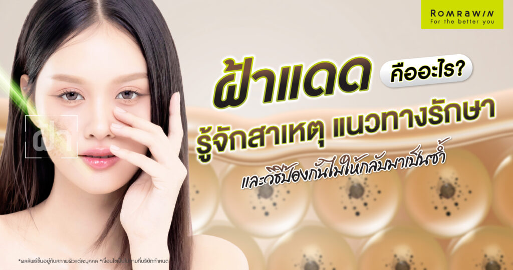 ฝ้าแดด คืออะไร? รู้จักสาเหตุ แนวทางรักษา และวิธีป้องกันไม่ให้กลับมาเป็นซ้ำ 1 ฝ้าแดด