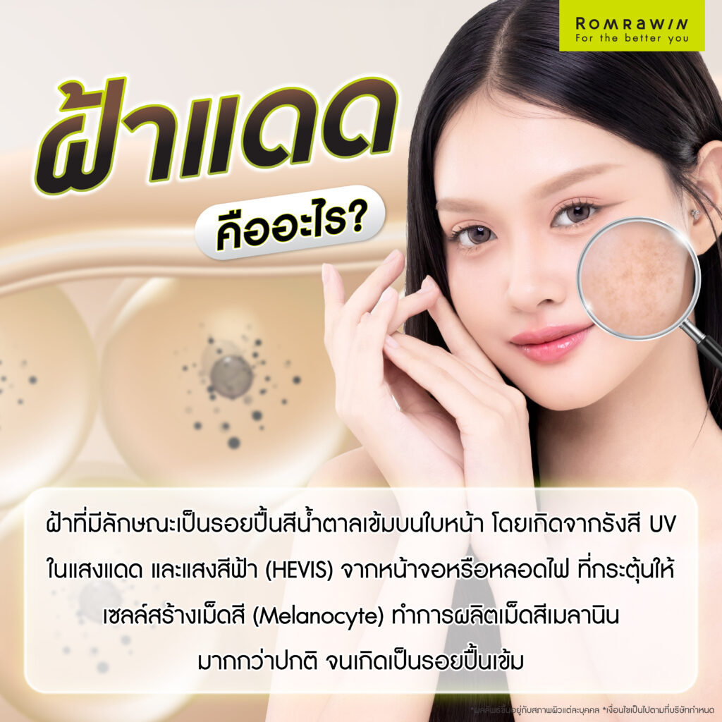 ฝ้าแดด คืออะไร? รู้จักสาเหตุ แนวทางรักษา และวิธีป้องกันไม่ให้กลับมาเป็นซ้ำ 2 ฝ้าแดดคืออะไร?
