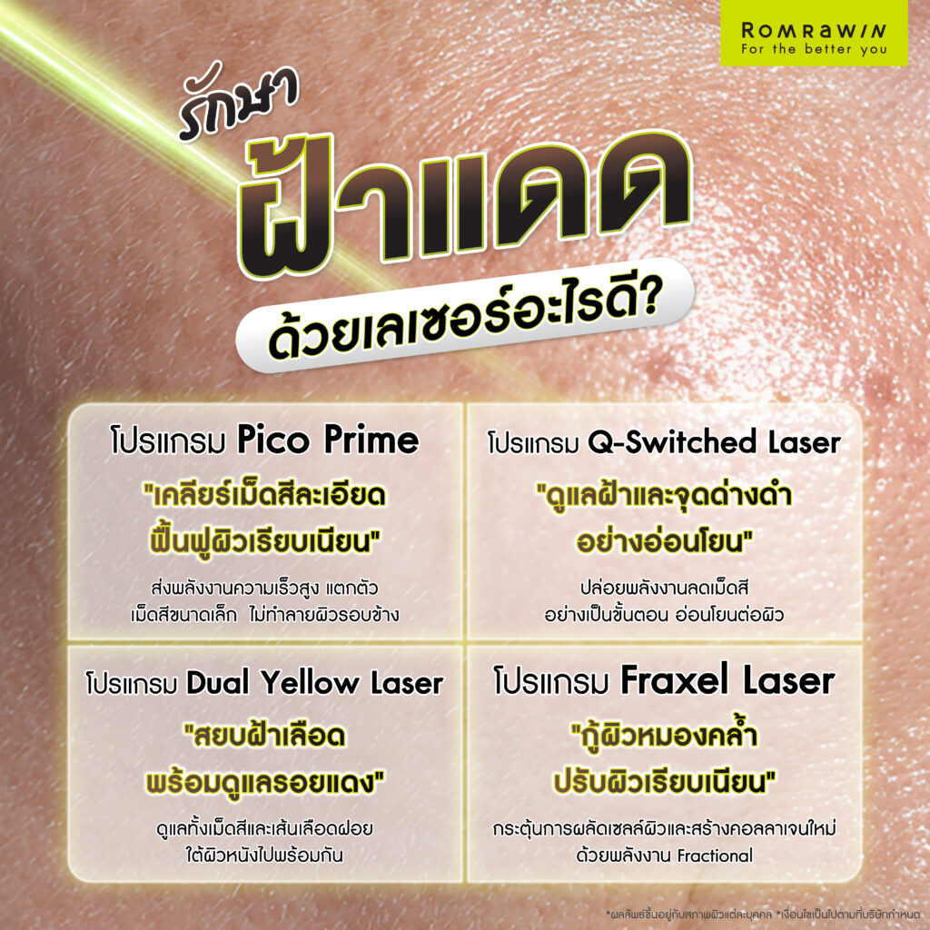 ฝ้าแดด คืออะไร? รู้จักสาเหตุ แนวทางรักษา และวิธีป้องกันไม่ให้กลับมาเป็นซ้ำ 5 รักษาฝ้าแดดด้วยเลเซอร์อะไรดี?