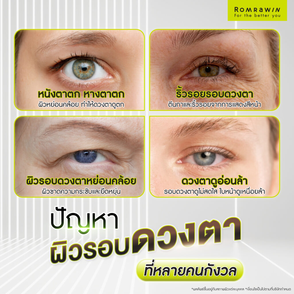 ปัญหาผิวรอบดวงตาที่หลายคนกังวล