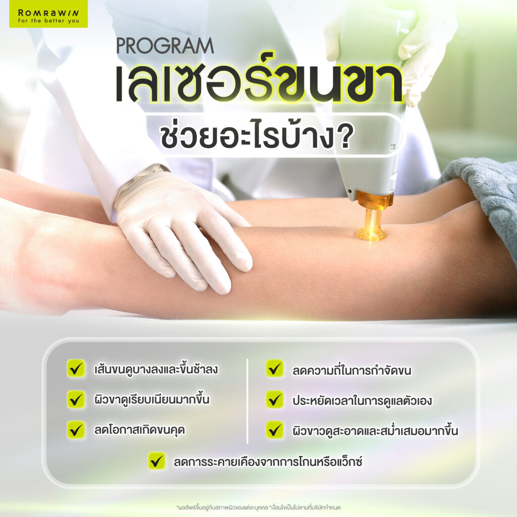 เลเซอร์ขนขา ทางเลือกเพื่อผิวขาเรียบเนียน ลดปัญหาขนคุด 3 เลเซอร์ขนขา ช่วยเรื่องอะไรได้บ้าง?