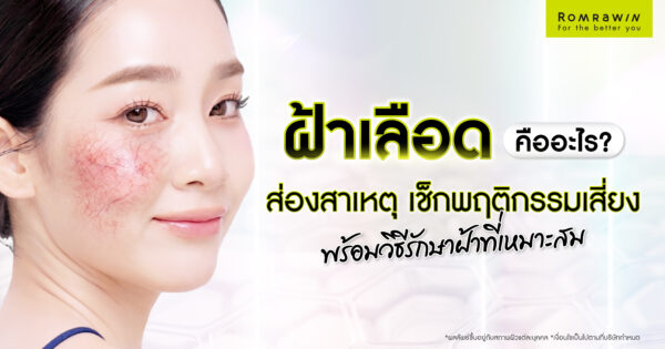 ฝ้าเลือด