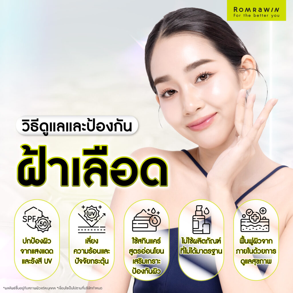 ฝ้าเลือดคืออะไร? ส่องสาเหตุ เช็กพฤติกรรมเสี่ยง พร้อมวิธีรักษาฝ้าที่เหมาะสม 5 วิธีดูแลและป้องกันฝ้าเลือด